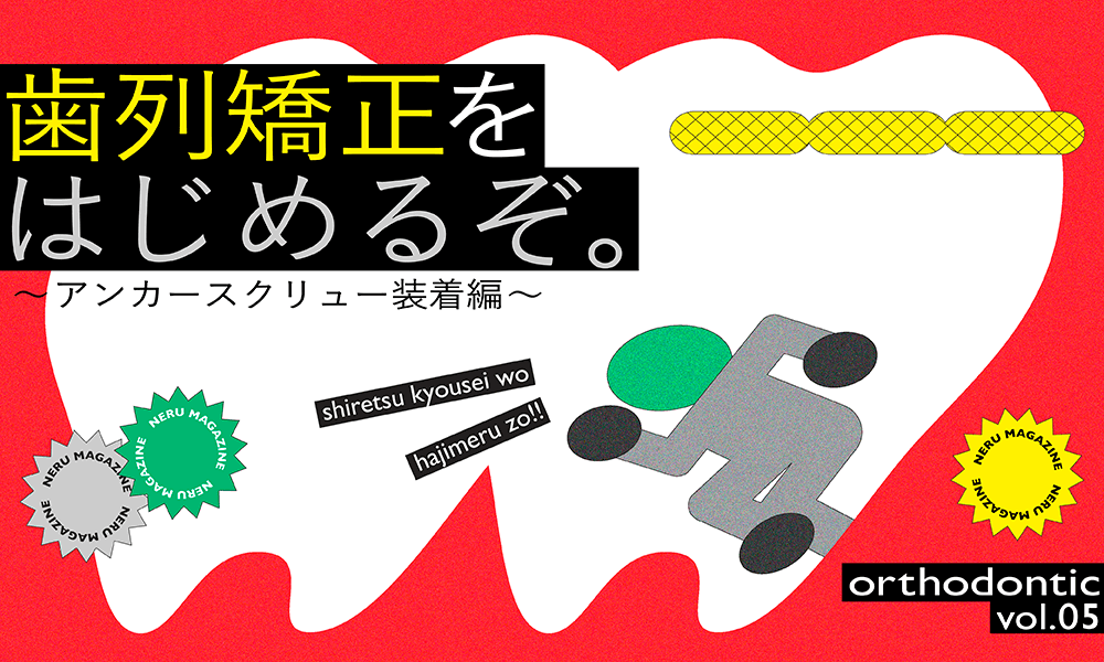 歯列矯正をはじめるぞ。〜アンカースクリュー装着編〜